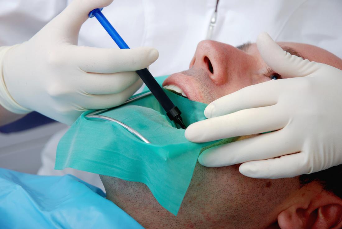 ¿Qué es una endodoncia multirradicular?