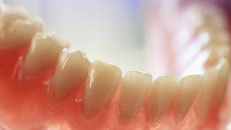profundizar Incompetencia travesura Cuál es la mejor dentadura postiza? | Bladé Grup
